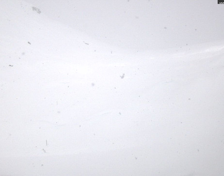 Heilbronner Hütte: Scheidsee