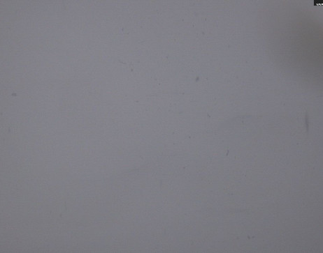 Heilbronner Hütte: Scheidsee