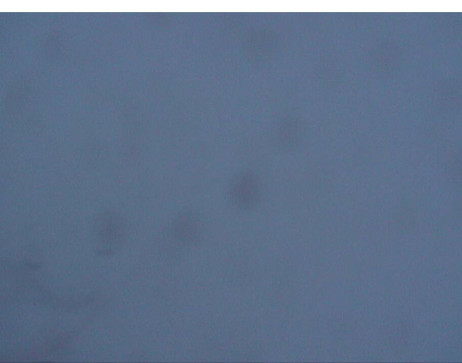 Silvretta Montafon: Kapell